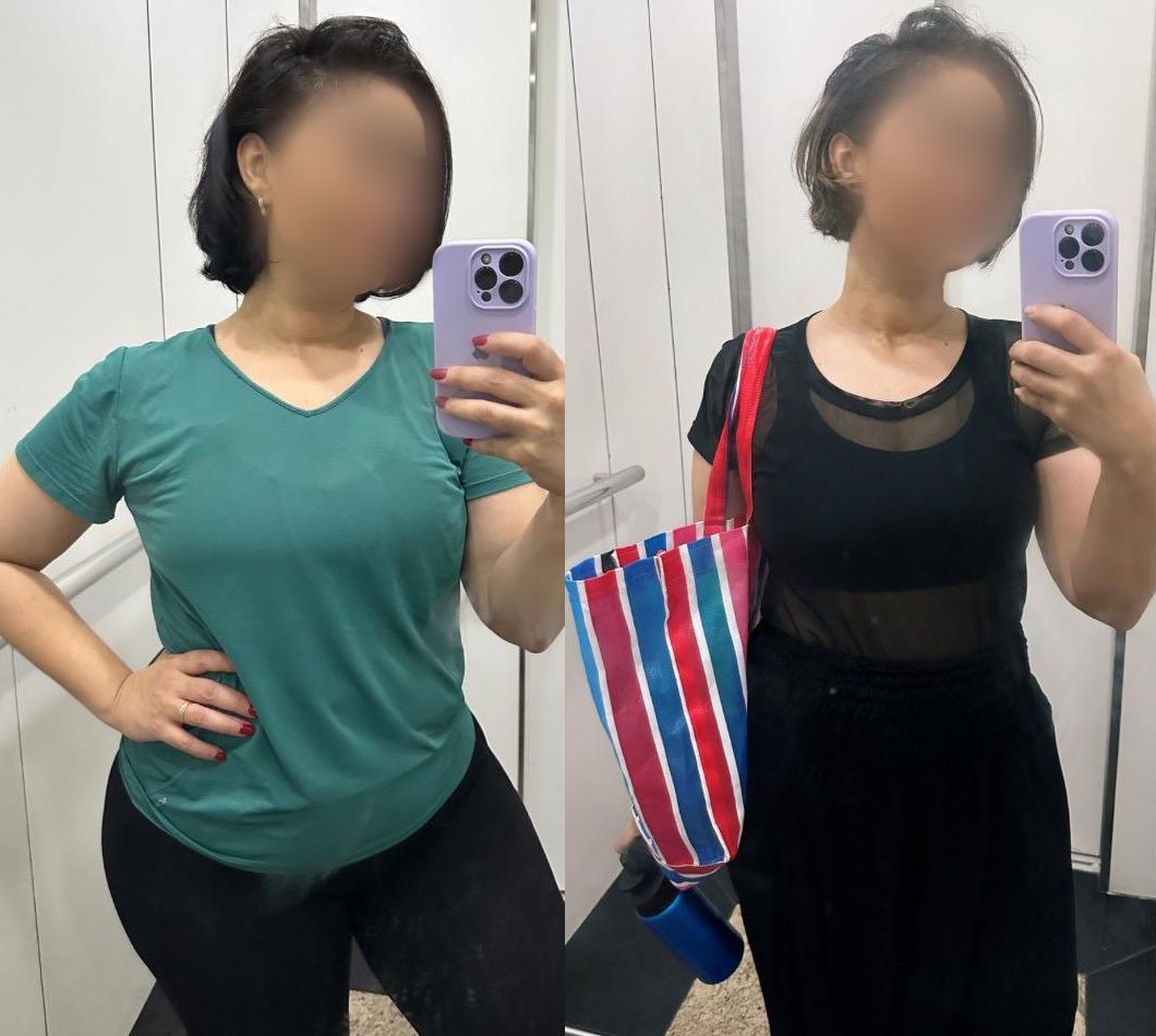 Antes e depois 2